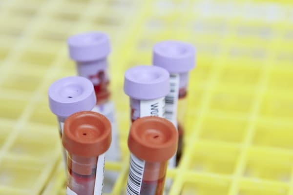 Blood samples